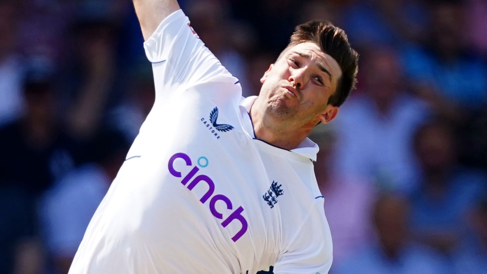 Read more about the article Jamie Overton: England sweat on Surrey seamer's health for summer season Exams upcoming tension break prognosis – Sky Sports activities